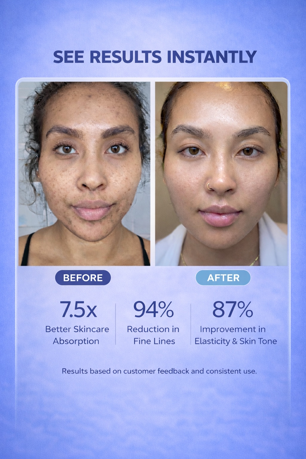 Herena SkinReset™ 5-In-1 Red & Blue Light Thermal Facial Device