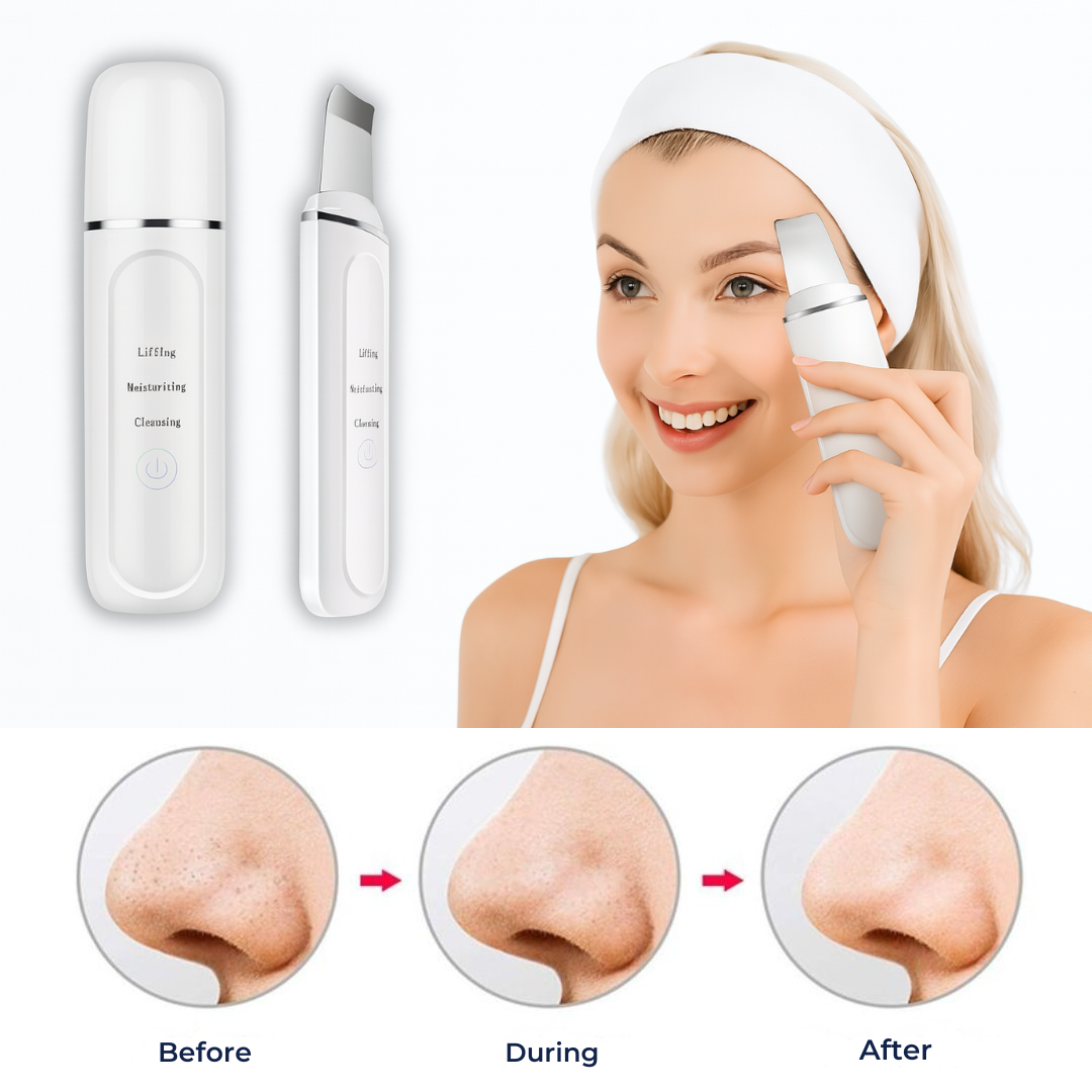 Ultrasonic Facial Cleansing Wand | 33,000 Vibrations | At-Home Skincare Tool